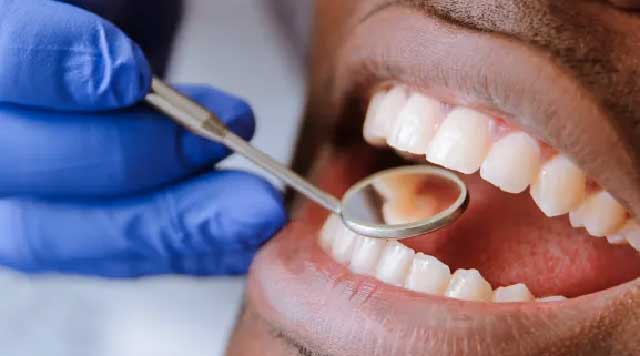Comment renforcer des dents déchaussées ?