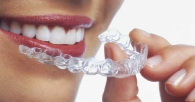 Aligneurs invisibles pour les dents