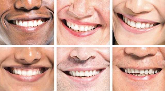 10 pays dont les citoyens ont des dents saines