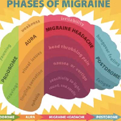 prodrome, Aura, Migraine