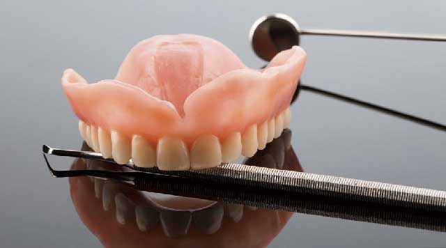 Qu'est-ce qu'un rebasage de prothèse dentaire ?