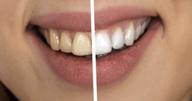 Comment éliminer le tartre des dents ?