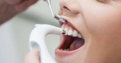 Qu'est-ce que le détartrage dentaire ?