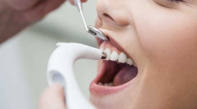 Qu'est-ce que le détartrage dentaire ?